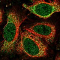 Anti-NEK6 antibody produced in rabbit HPA056828-100UL