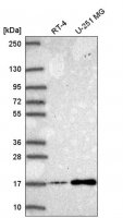 Anti-NEK6 antibody produced in rabbit HPA056828-100UL