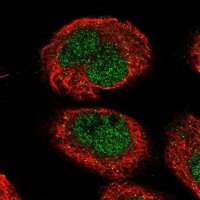 Anti-NEMP1 antibody produced in rabbit 