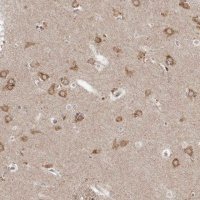Anti-NENF antibody produced in rabbit 