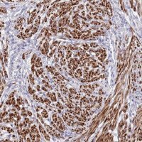 Anti-NET1 antibody produced in rabbit