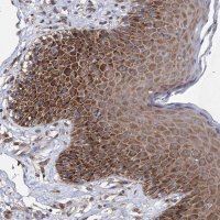 Anti-NFU1 antibody produced in rabbit