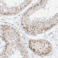 Anti-NHSL1 antibody produced in rabbit