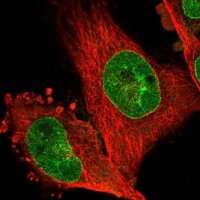 Anti-NHSL1 antibody produced in rabbit