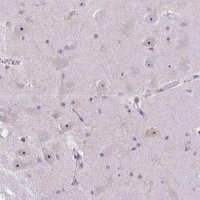 Anti-NIFK antibody produced in rabbit
