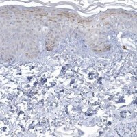 Anti-NIPAL1 antibody produced in rabbit 