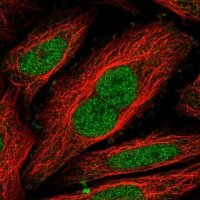 Anti-NIPBL antibody produced in rabbit