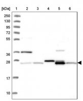 Anti-NIPSNAP3A antibody produced in rabbit