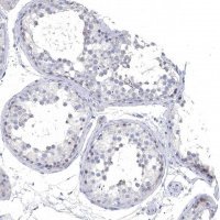 Anti-NLRP14 antibody produced in rabbit 