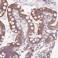 Anti-NMRK1 antibody produced in rabbit 
