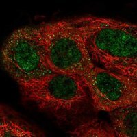 Anti-NMRK1 antibody produced in rabbit 