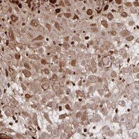 Anti-NOG antibody produced in rabbit 
