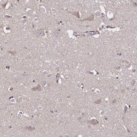 Anti-NOG antibody produced in rabbit 