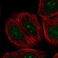 Anti-NOM1 antibody produced in rabbit 
