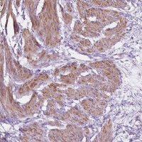 Anti-NOS1AP antibody produced in rabbit 
