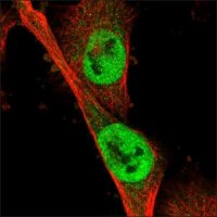 Anti-NOTUM antibody produced in rabbit HPA023041-100UL