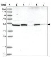 Anti-NOX1 antibody produced in rabbit HPA035299-100UL