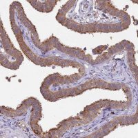 Anti-NPHP1 antibody produced in rabbit 