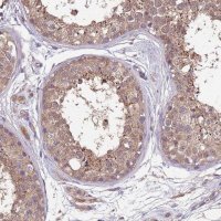 Anti-NPHP1 antibody produced in rabbit 