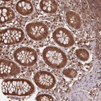 Anti-NPRL2 antibody produced in rabbit