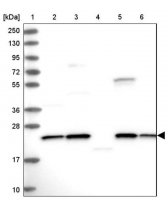 Anti-NPVF antibody produced in rabbit 