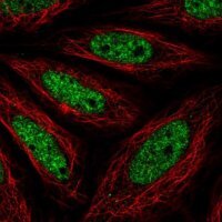 Anti-NR4A2 antibody produced in rabbit 