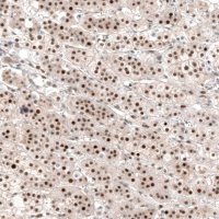 Anti-NR4A3 antibody produced in rabbit 