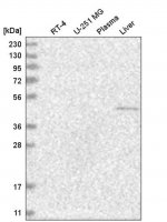 Anti-NR6A1 antibody produced in rabbit HPA031461-100UL