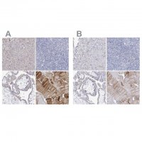 Anti-NRAP antibody produced in rabbit