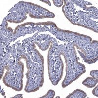 Anti-NRARP antibody produced in rabbit 