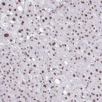 Anti-NRBF2 antibody produced in rabbit HPA059477-100UL