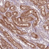 Anti-NRDE2 antibody produced in rabbit 