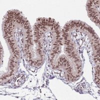 Anti-NRIP1 antibody produced in rabbit 