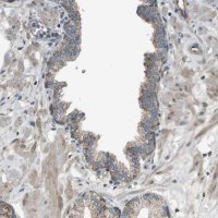 Anti-NRK antibody produced in rabbit 
