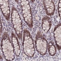 Anti-NSMCE1 antibody produced in rabbit