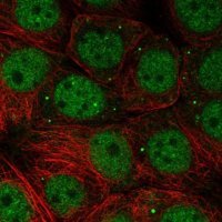 Anti-NSMCE1 antibody produced in rabbit
