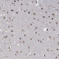 Anti-NSMCE4A antibody produced in rabbit 