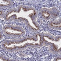Anti-NSUN6 antibody produced in rabbit 