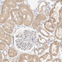 Anti-NT5C antibody produced in rabbit 