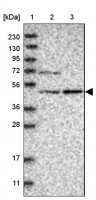 Anti-NT5DC1 antibody produced in rabbit HPA030352-100UL