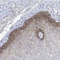 Anti-NTN3 antibody produced in rabbit
