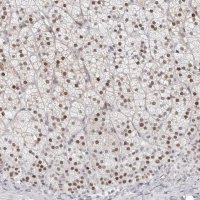 Anti-NTPCR antibody produced in rabbit HPA028125-100UL