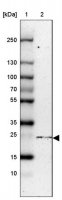 Anti-NTPCR antibody produced in rabbit HPA028125-100UL