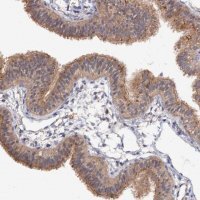 Anti-NUDCD2 antibody produced in rabbit HPA037384-100UL
