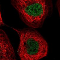Anti-NUDT2 antibody produced in rabbit HPA044903-100UL