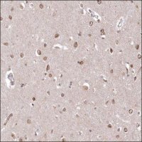 Anti-NUP155 antibody produced in rabbit HPA037774-100UL