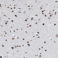 Anti-NUP88 antibody produced in rabbit