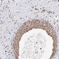 Anti-OAS1 antibody produced in rabbit 