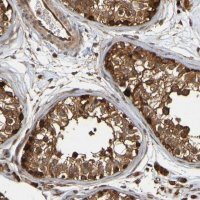 Anti-OCRL antibody produced in rabbit 