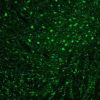 Anti-OGFOD1 antibody produced in rabbit 